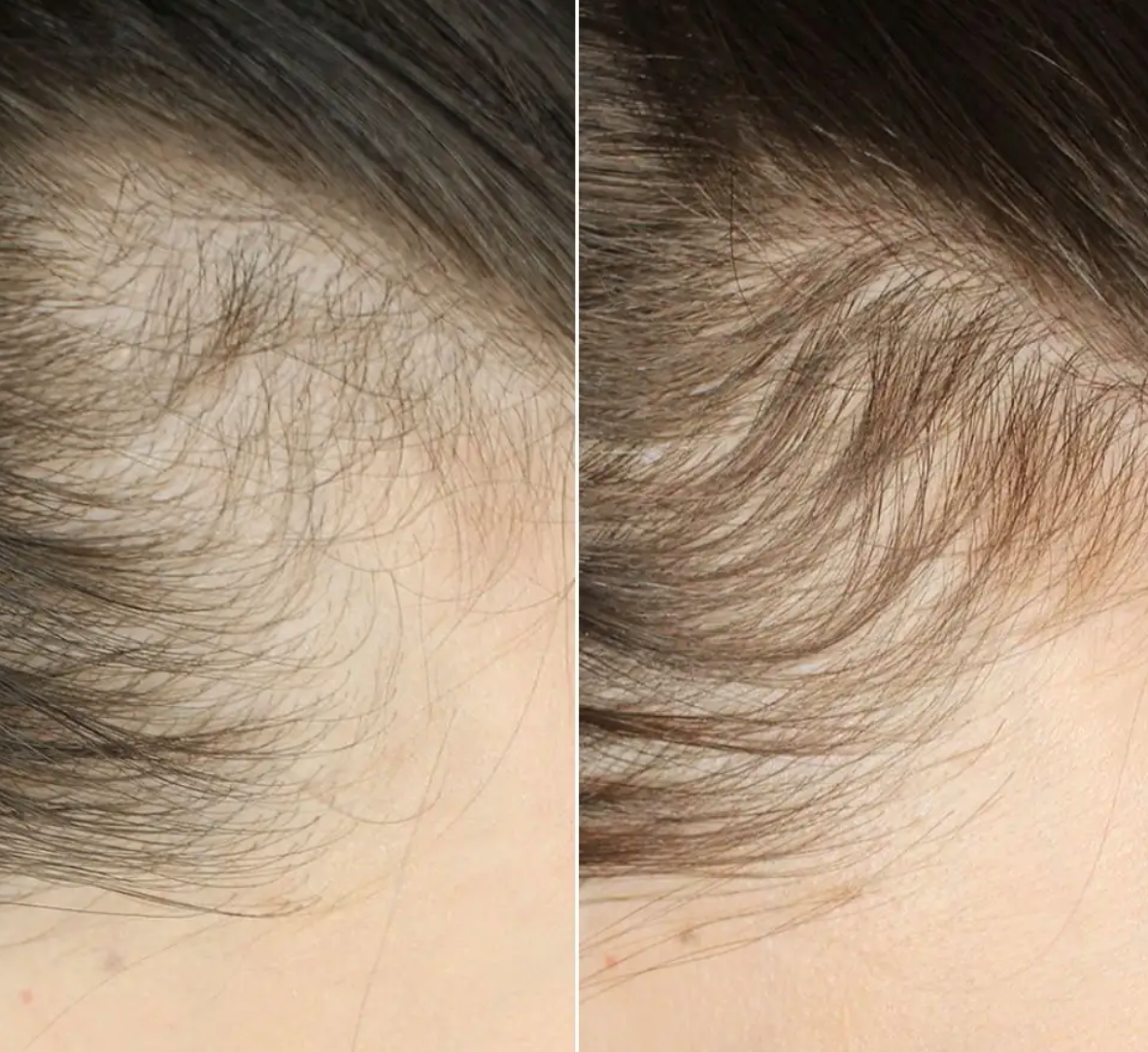 Escova Massageadora – Relajación y Cuidado en Cada Movimiento !!!